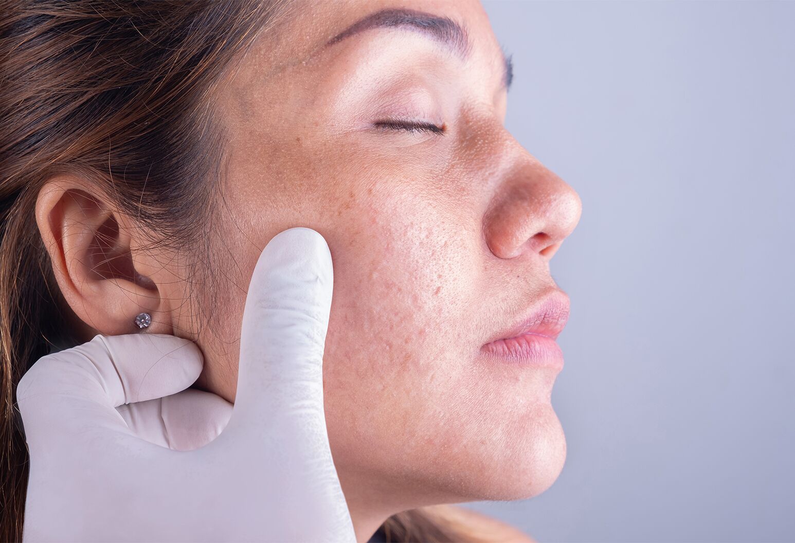 dermatologist in Ludhiana