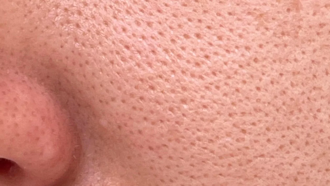 how-to-reduce-open-pores