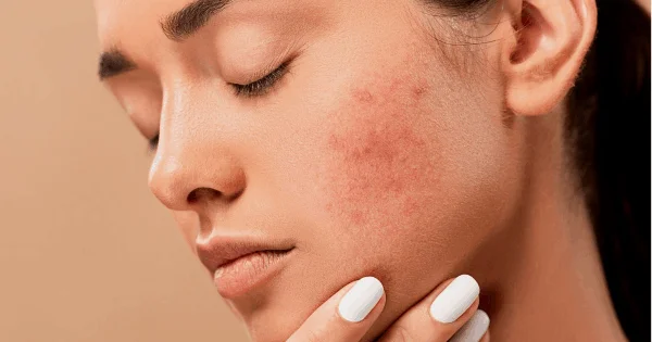 best hydrafacial clinic ludhiana