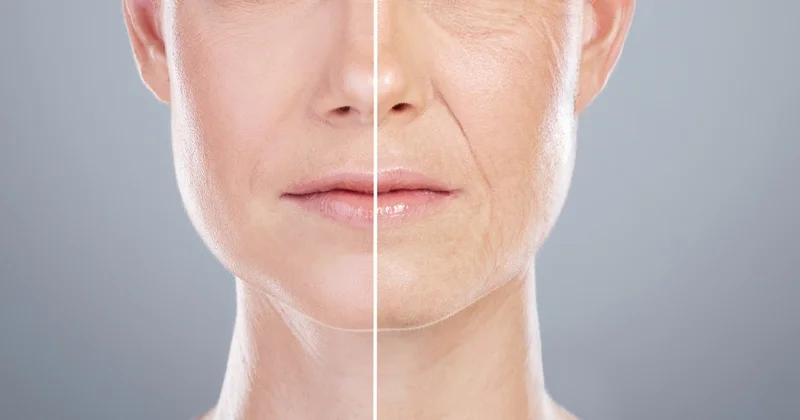 Anti Aging Treatment Ludhiana