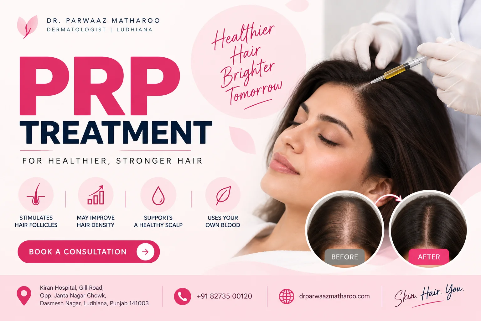 PRP Treatment
