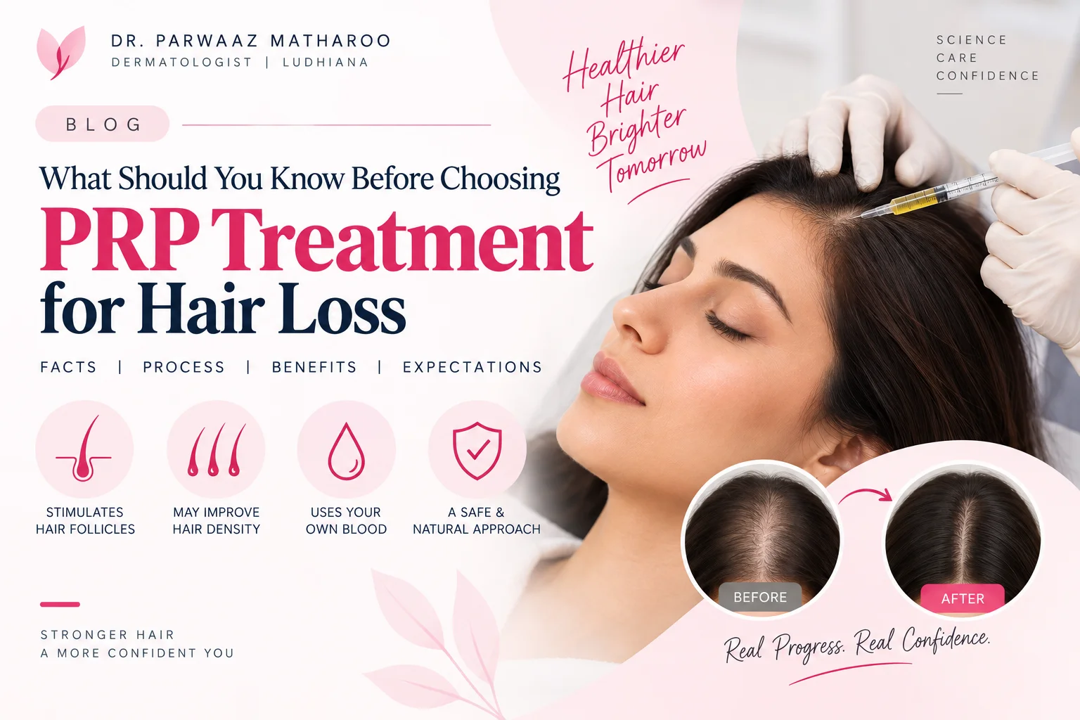 /prp-treatment-for-hair-loss/